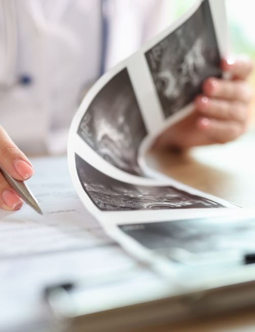 preguntas frecuentes Ginecologia