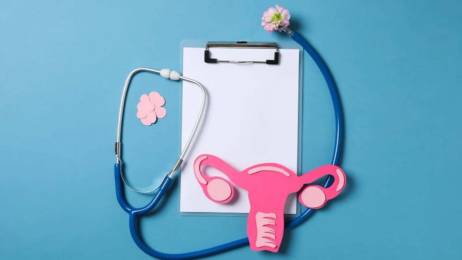 Endometriosis: Comprendiendo y tratando esta condición en Monterrey